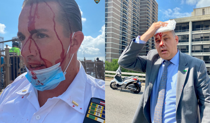 NYPD Chief beat-up by protestors